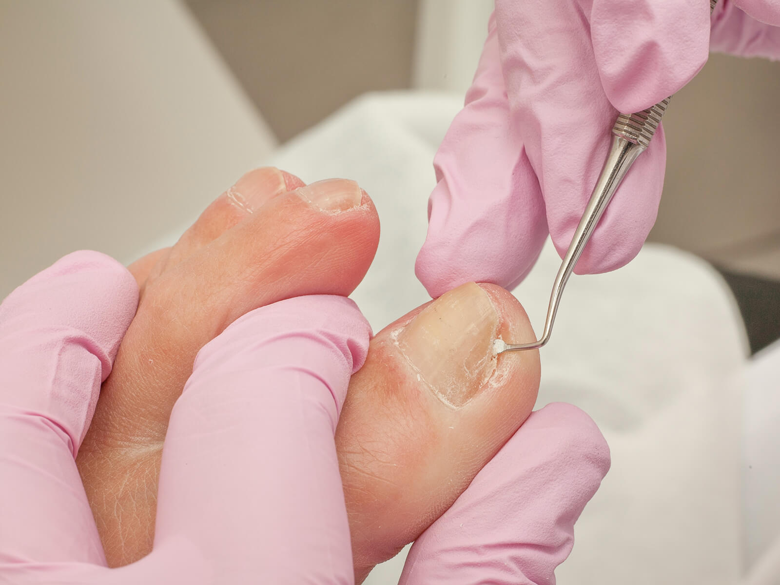 west wales podiatry nail surgery